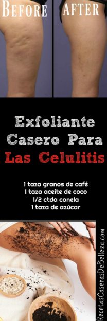 Exfoliante Casero para las Celulitis 