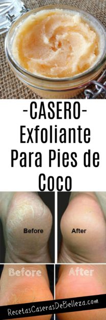 Exfoliante Casero Para Pies de coco