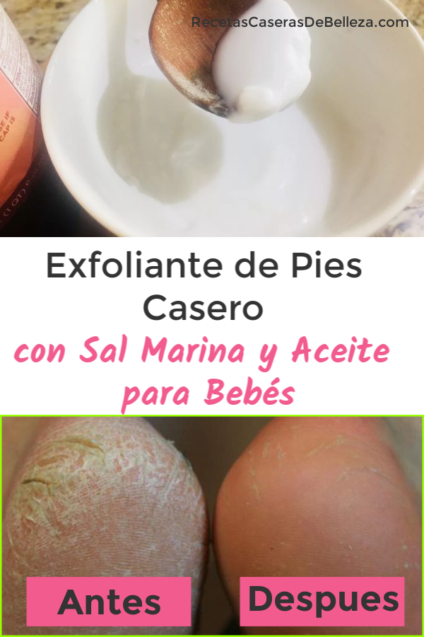 Exfoliante de Pies Casero